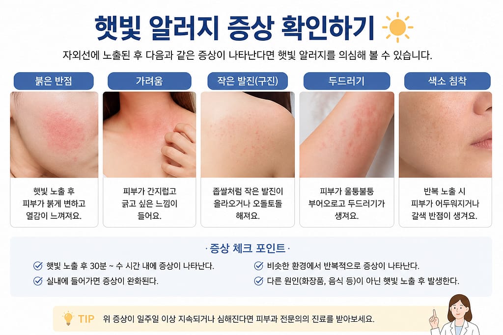 햇빛 알러지